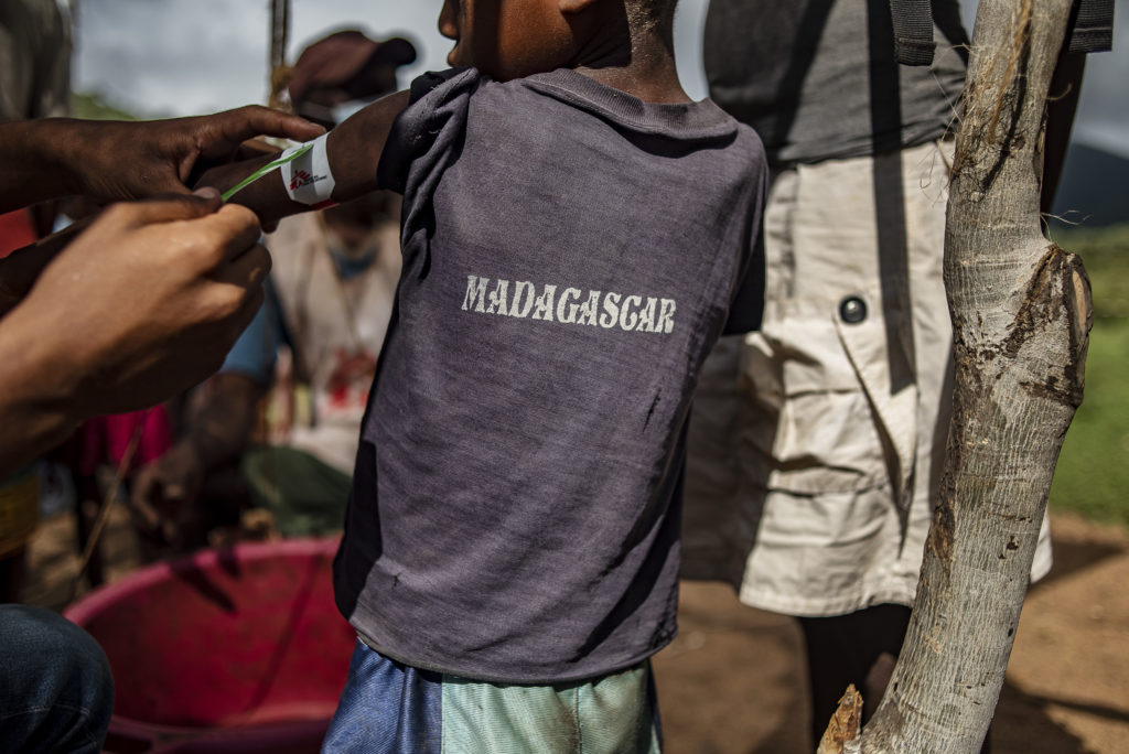 Pojan vasenta kyynärvartta mitataan, T-paiden selkämyksessä lukee Madagascar.